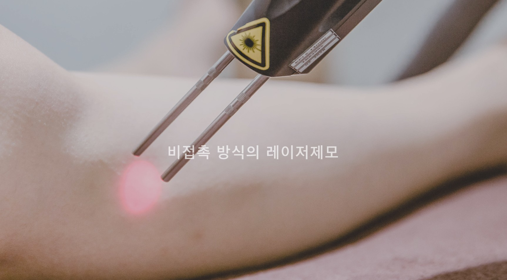 수염 레이저제모 잠실피부과 닥터에버스 수염 레이저제모 잠실피부과 닥터에버스